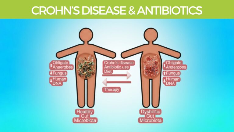 Crohn’s Disease Causes antibiotics microbiome