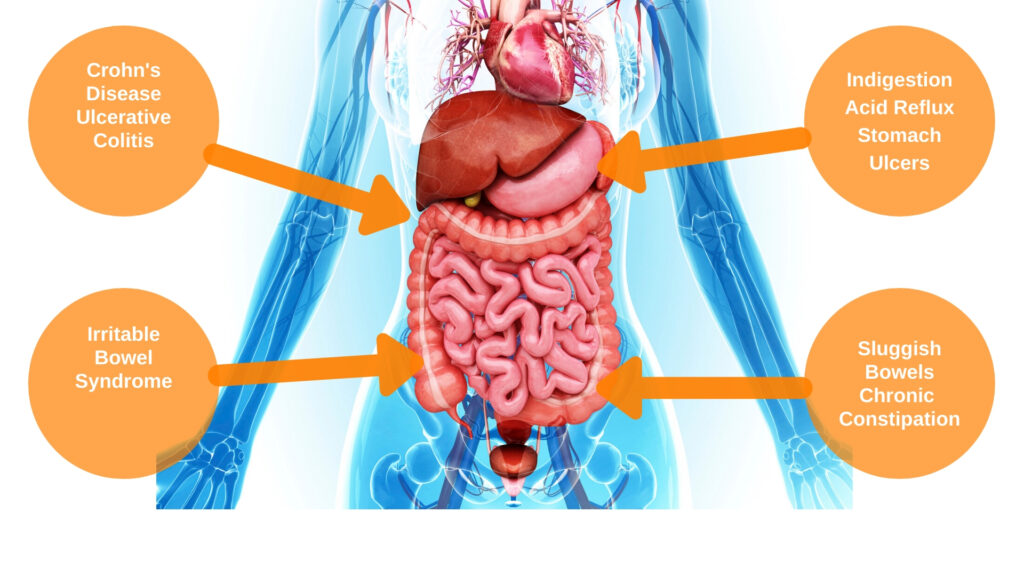 gut dysbiosis