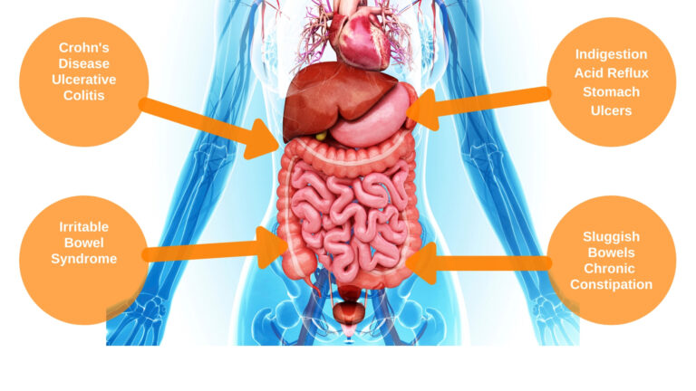 Gut Dysbiosis