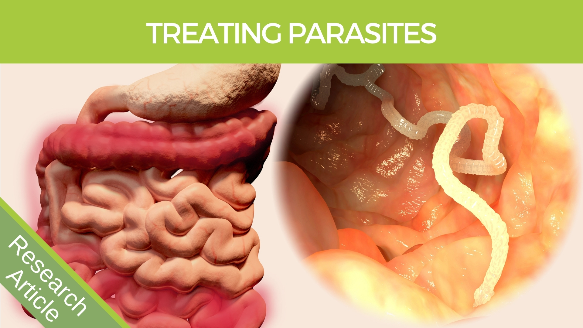 parasites in the human body treatment
