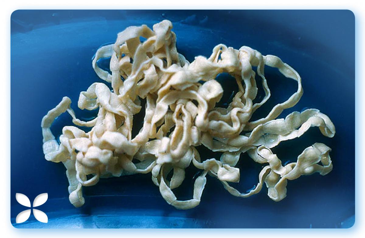 tapeworm in humans