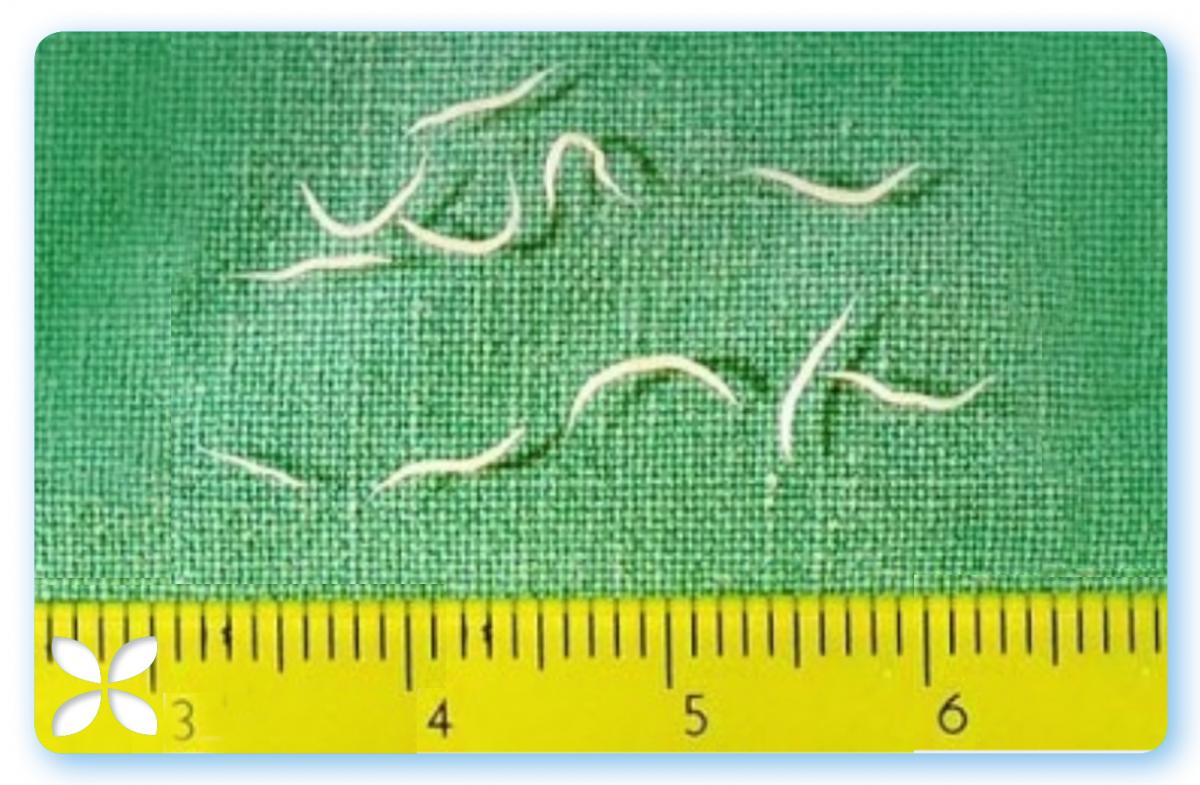 Pinworm treament