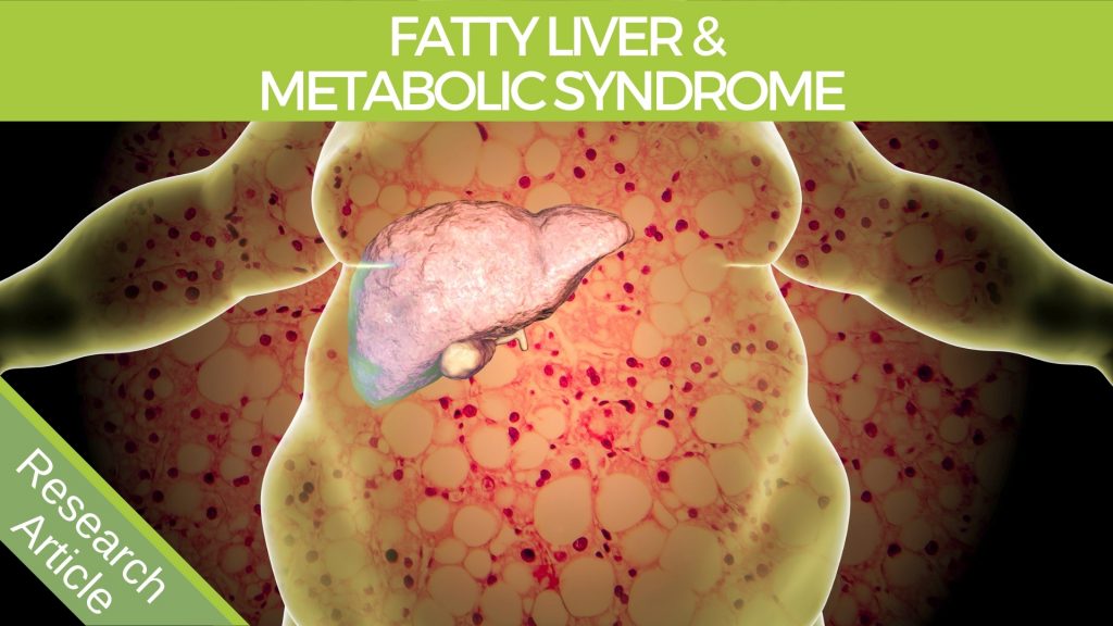 an illustration of a fatty liver and metabolic syndrome