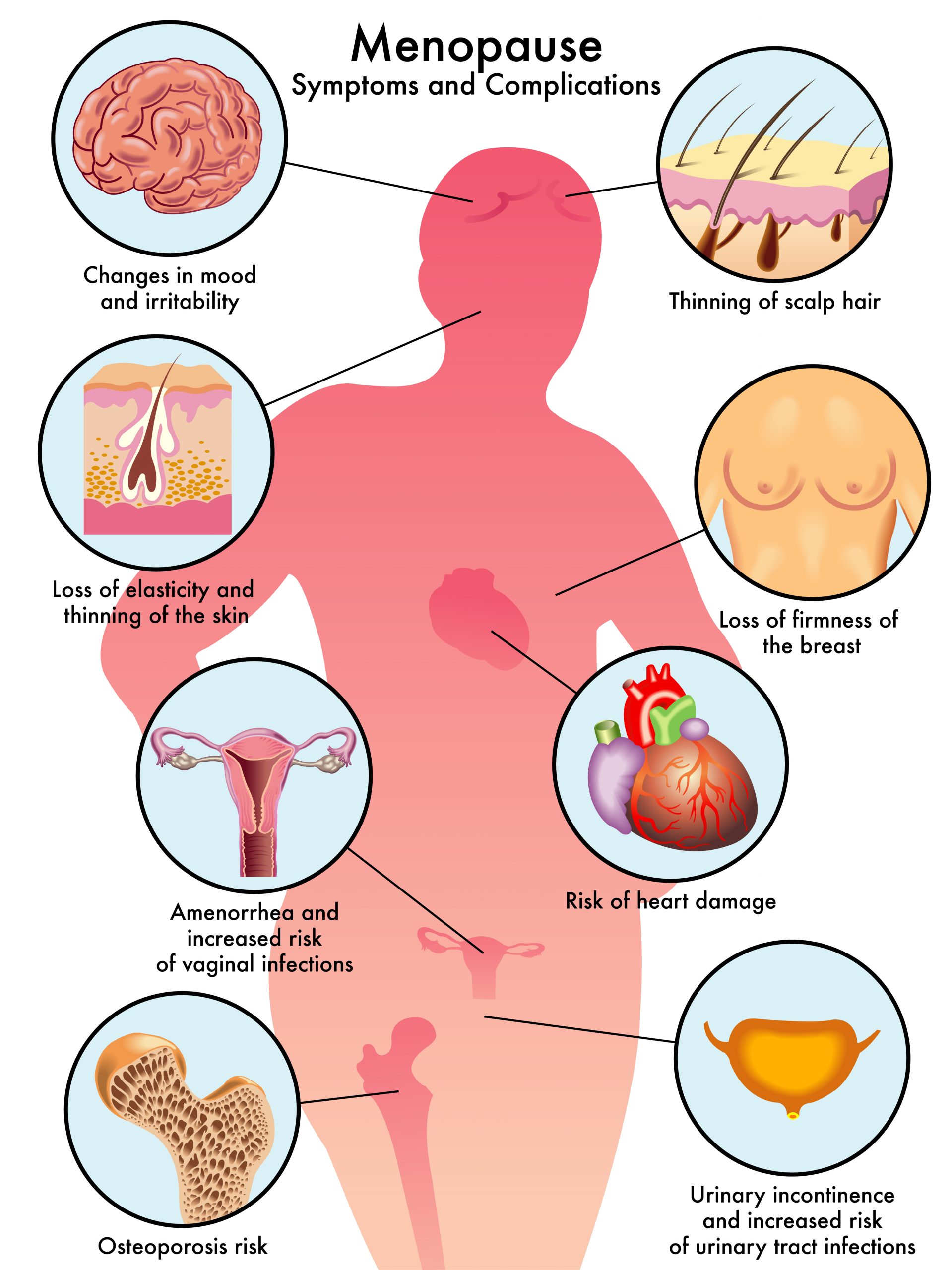 menopause symptoms and complications infographic