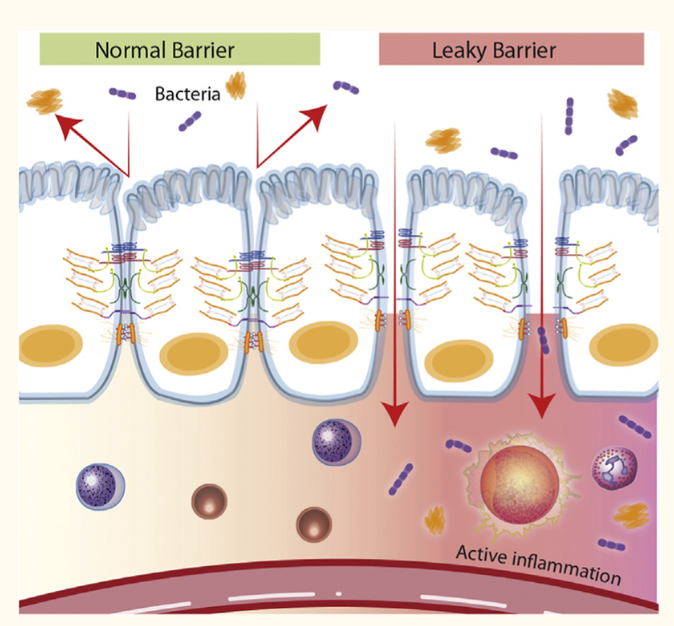 Leaky-Gut-Syndrome explained with natural solutions
