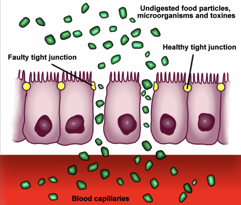 Leaky-Gut-tight-junctions
